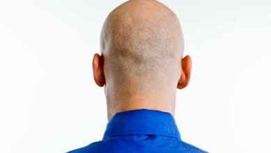 Indian bride rejects groom at wedding after discovering his bald truth