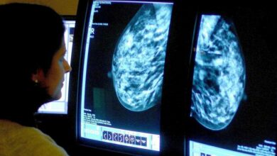 Cancer care compromised by staff shortages, radiology leaders warn NHS