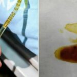 Liver fluke: Chinese woman discovers severe infection due to family&#8217;s raw fish habit | Thaiger