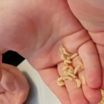 Turkish boy discovers 11 maggots after troubling eye irritation | Thaiger