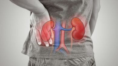 End-stage kidney disease diagnosis shocks 24 year old man