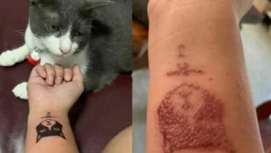 Henna tattoo horror: Thai woman’s ordeal serves as an allergy warning