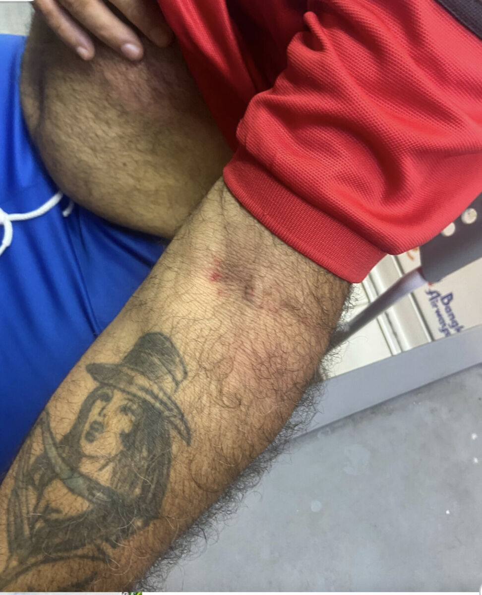 Unprovoked attack on foreign tourist by teens threatens Pattaya's tourism reputation | News by Thaiger