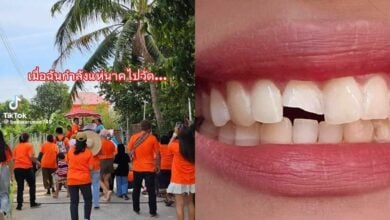 Unusual TikTok incident: Tooth breaks into three pieces after hit by donation coin (Video)
