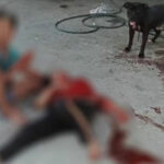 Neighbour&#8217;s pit bull goes on rampage, seriously injures woman | Thaiger