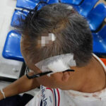Thai tourist struck on the head at Sattahip temple | Thaiger