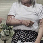 Acid attack leaves Burmese mother and baby severely injured | Thaiger