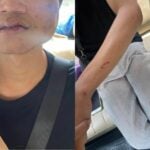 Swipe fright: Thai man seeks justice after date turns brutal | Thaiger