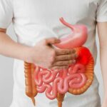 Colorectal cancer rates rising among the young globally and even in Thailand | Thaiger
