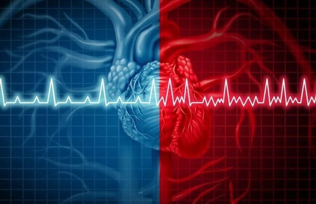 Atrial fibrillation is becoming more common and can lead to heart failure