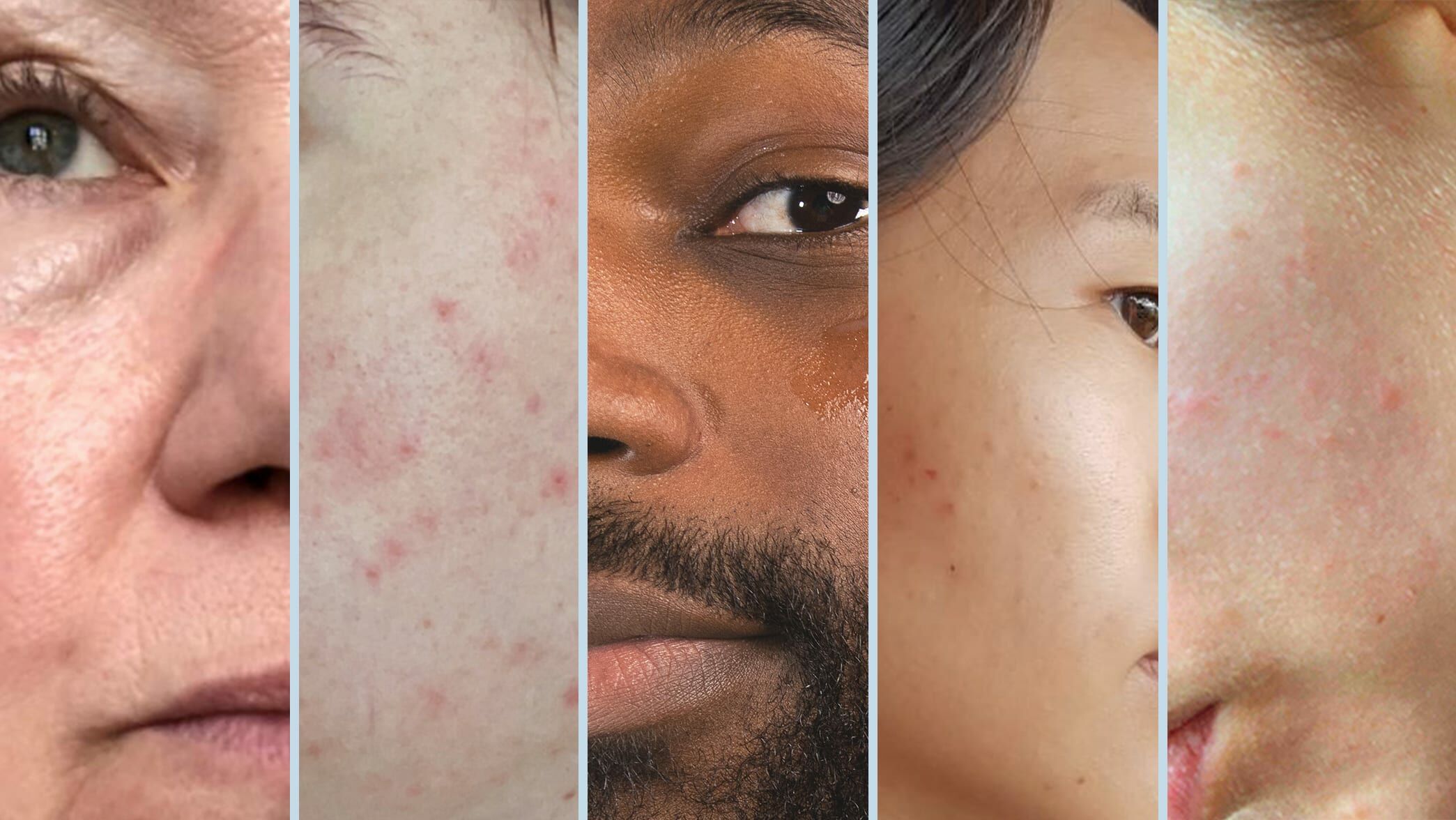 Find out your skin type