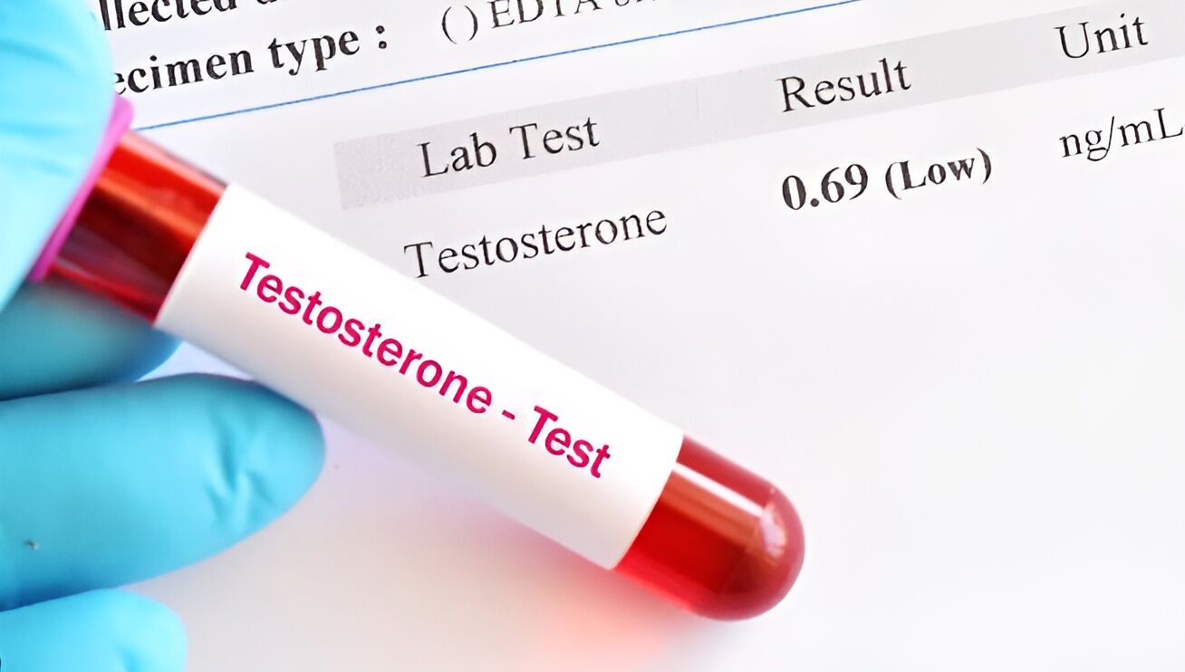 Low testosterone levels increases risk of dying from cardiovascular ...