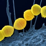 Deadly flesh-eating bacteria spreading in Japan | Thaiger