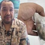 Cancer patient narrowly avoids death after hospital&#8217;s negligence | Thaiger