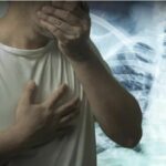 TB outbreak looming on Thailand-Myanmar border | Thaiger