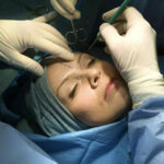 Ads for cosmetic procedures by medical professionals banned | Thaiger