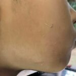 Worms emerge from boy&#8217;s face after medium&#8217;s treatment (video) | Thaiger