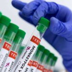 Asia on alert: Deadly new mpox strain hits Thailand | Thaiger