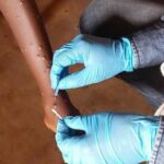 African travellers must register for health pass to combat mpox | Thaiger