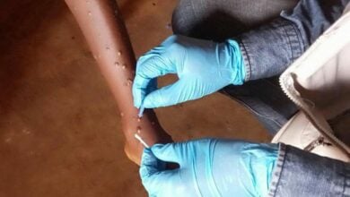 African travellers must register for health pass to combat mpox