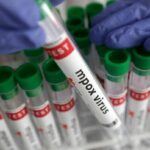 Thailand recovers first mpox clade Ib patient, no further cases | Thaiger