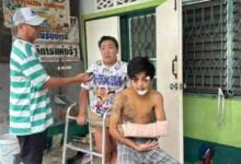 Teen severely injured in Pattaya hit-and-run, family seeks justice