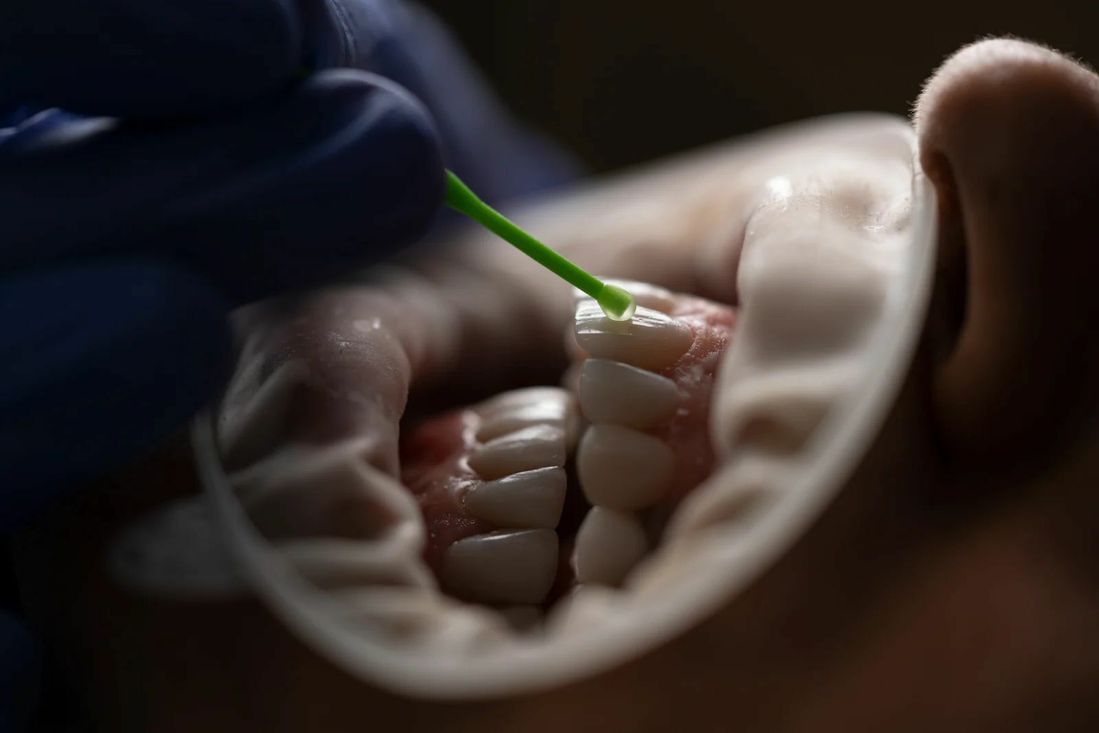 a person holding a green tubeDr F.Sharifi Dental care in Thailand