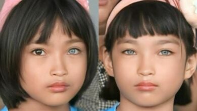 Laotian mother appeals for hearing aids for blue-eyed twins with rare condition