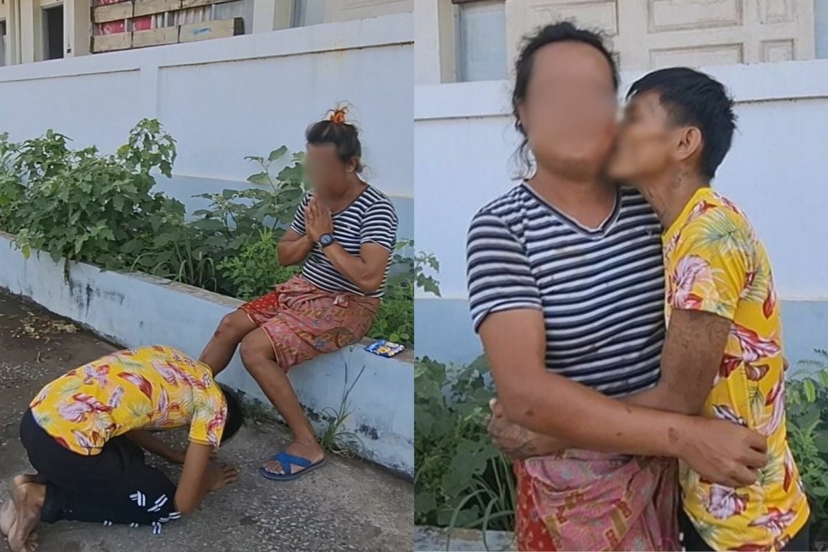 Thai man bites transgender girlfriend’s cheek but love heals the wound