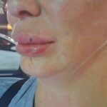 Speed of fright: Russian woman assaulted by Bolt rider in Pattaya | Thaiger