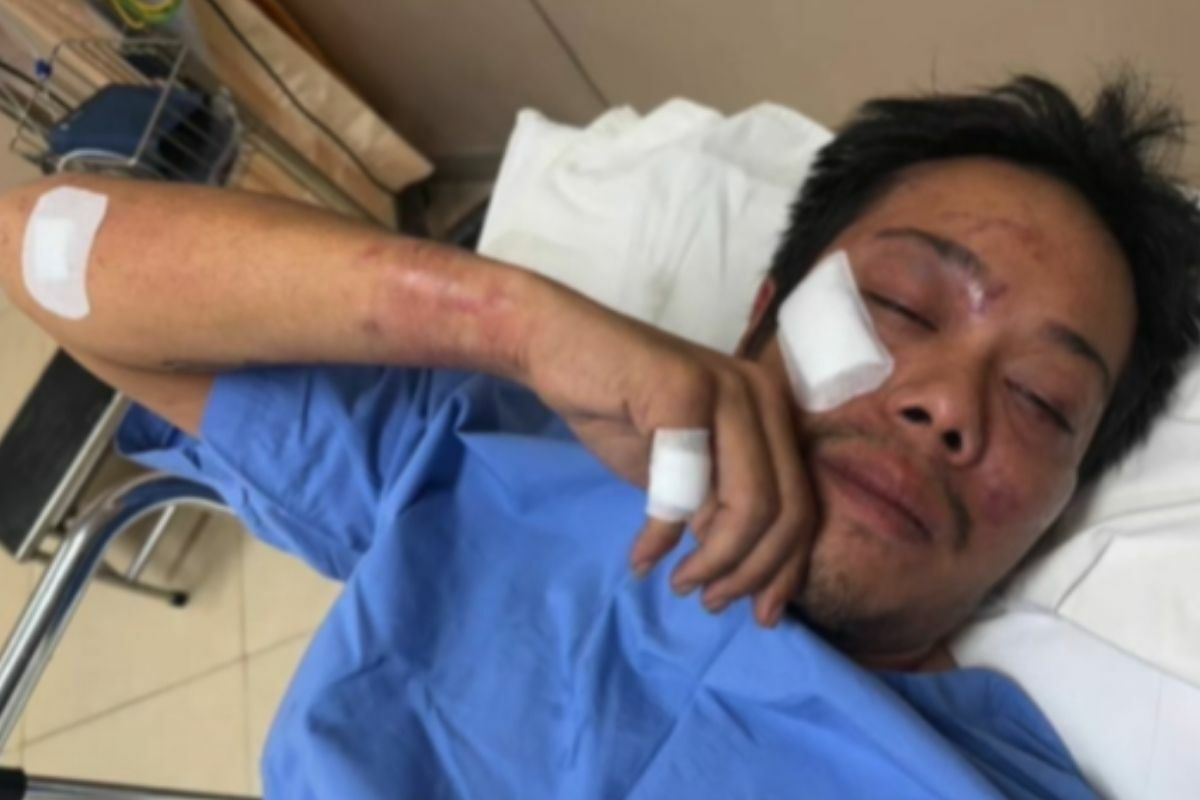 Thai man mistaken as drunk driving suspect and assaulted by police