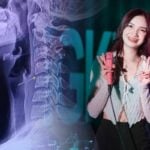 Thai singer dies from neck injury allegedly linked to massage in Udon Thani | Thaiger