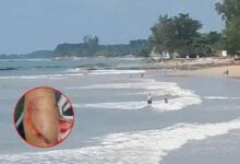 German woman bitten by suspected shark at Phang Nga beach