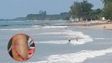 German woman bitten by suspected shark at Phang Nga beach