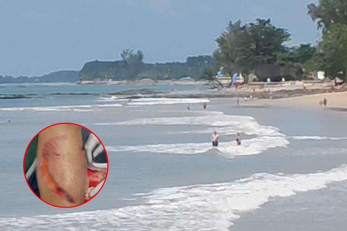 German woman bitten by suspected shark at Phang Nga beach