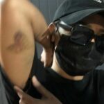 Entertainment worker assaulted at Surat Thani party | Thaiger