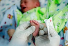 Fight for life: Urgent heart ops needed for 400 Thai newborns a year