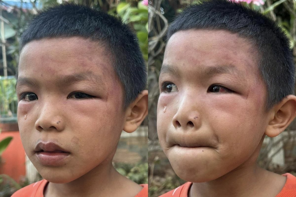 Young Thai boy rescued after absued by drug addict