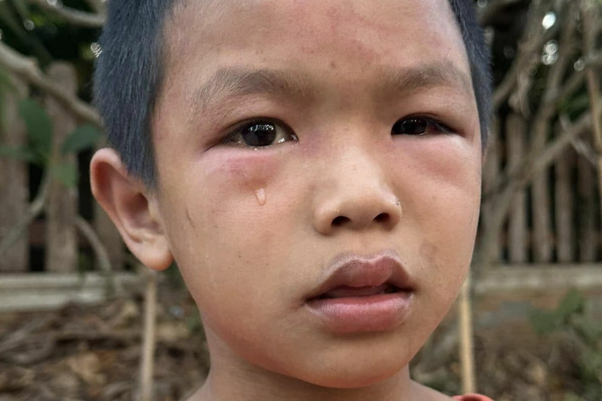 Seven year old boy abused by drug addict in Kalasin