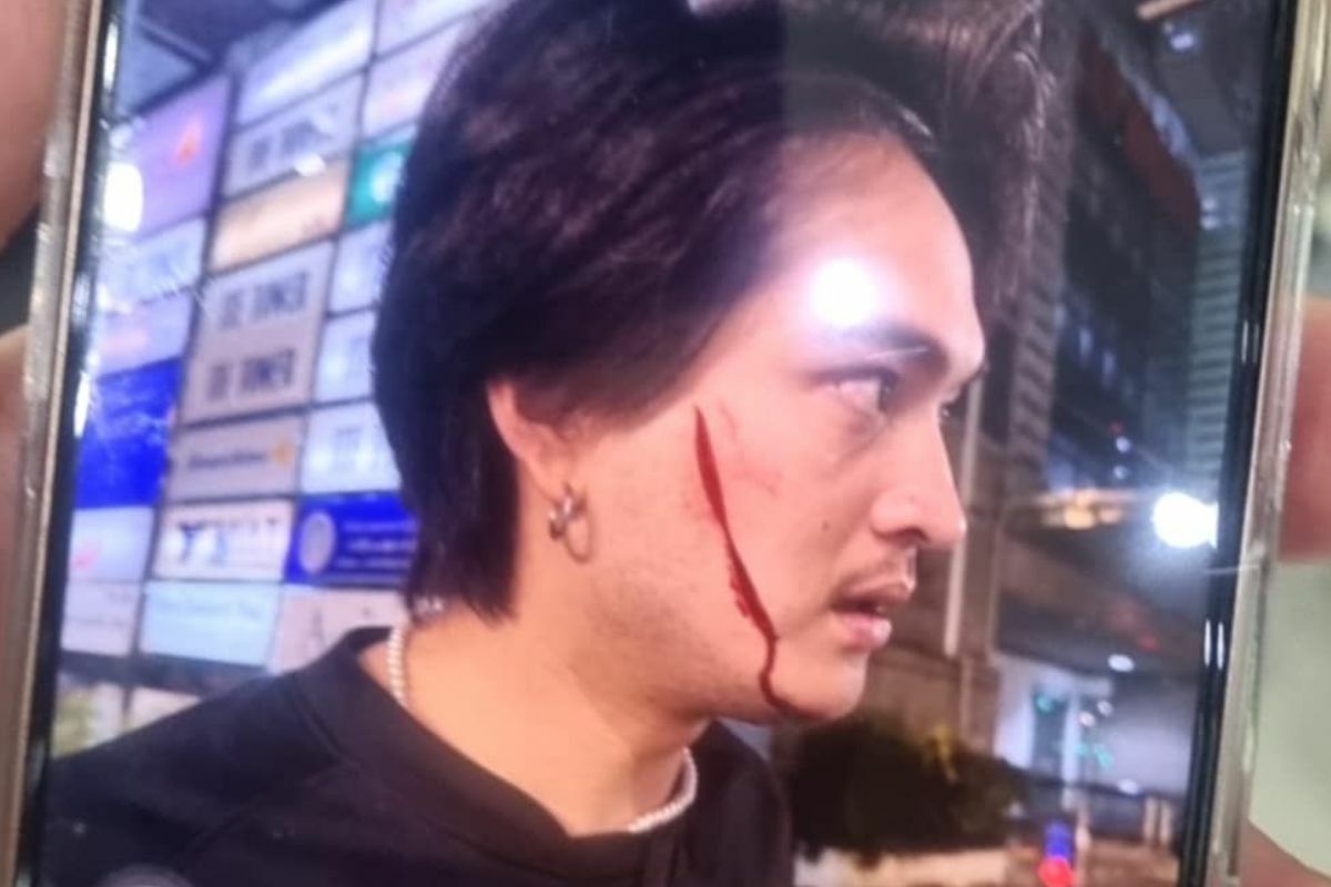 Thai man injured after fare dispute with taxi driver in Bangkok