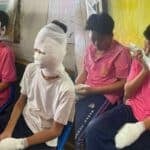 4 schoolboys injured in class science experiment gone wrong at Phetchabun