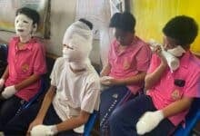 4 schoolboys injured in class science experiment gone wrong at Phetchabun