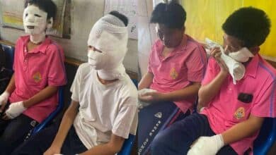 4 schoolboys injured in class science experiment gone wrong at Phetchabun