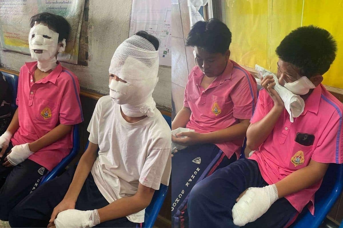 4 schoolboys injured in class science experiment gone wrong at Phetchabun