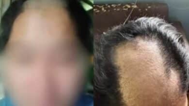 Thai woman abused, forced to shave head by cheating husband