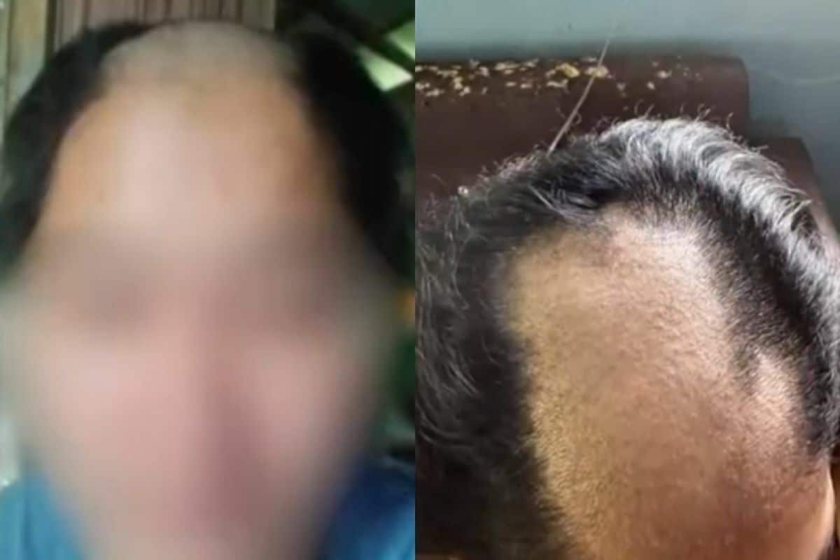 Thai woman abused, forced to shave head by cheating husband