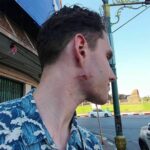 Swedish tourist bitten by macaque at Thai landmark | Thaiger