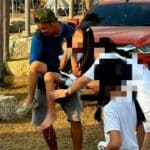 Pattaya locals demand action after stray dog attacks 10 year old Thai girl | Thaiger
