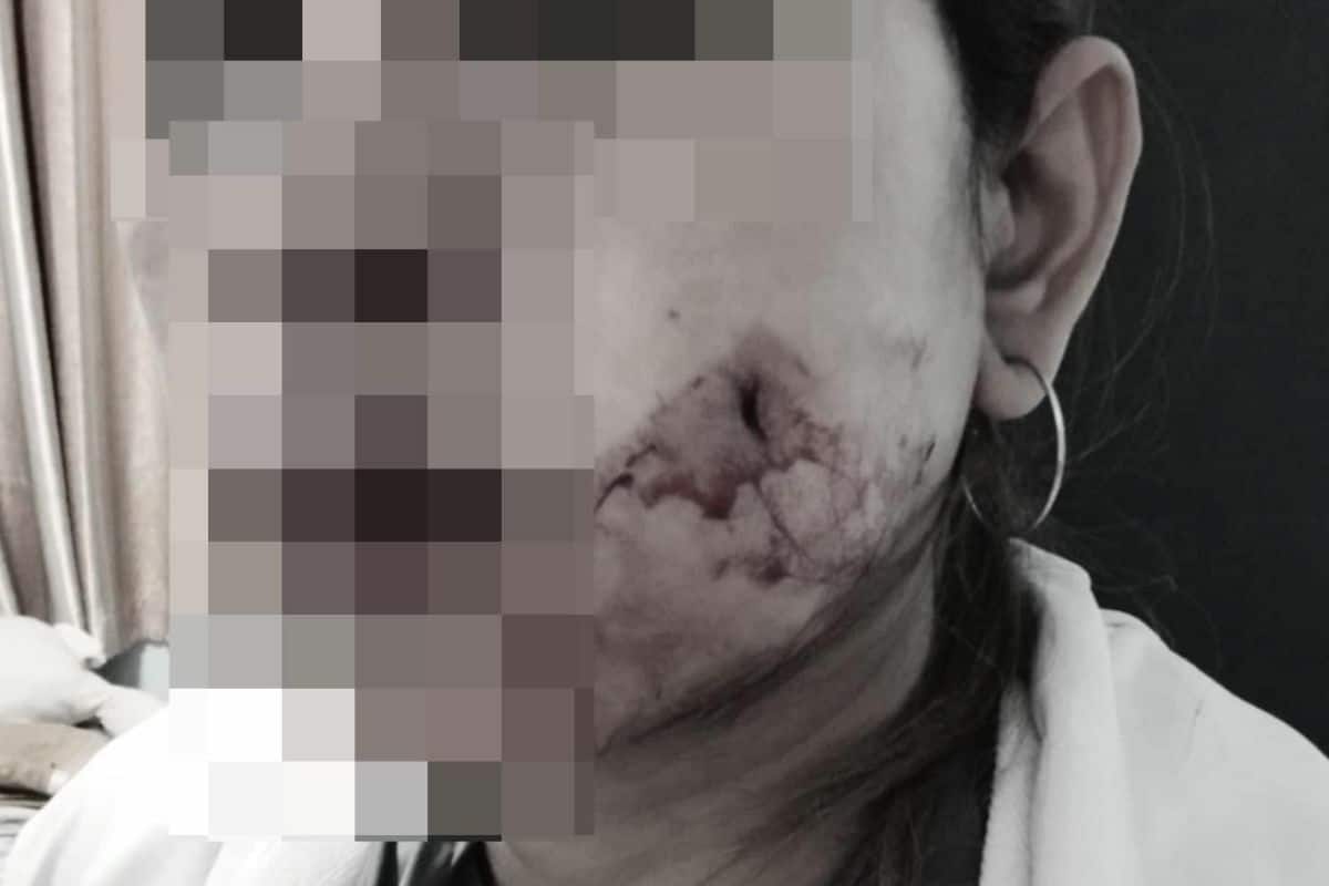 Bangkok woman suffers excessive blood loss after dimple surgery