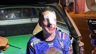 Icelandic man gets his face busted after falling into Pattaya drain